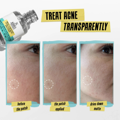 Сыворотка быстрого действия от прыщей Kiehl's Truly Targeted Acne-Clearing Solution Liquid Patch with Salicylic Acid 4 ml Mini