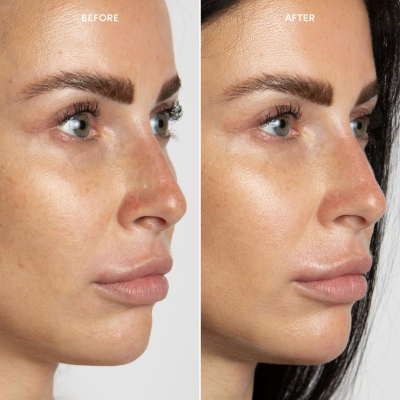 Інтенсивно зволожуючий крем MDO Intense Hydrating Moisturizer 10 ml 