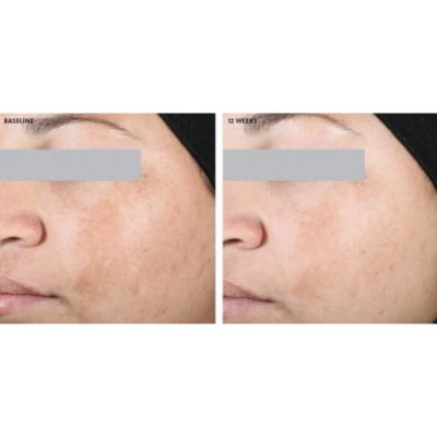 Сыворотка от пигментации SkinCeuticals Discoloration Defence Daily Corrective Serum 4 ml Mini