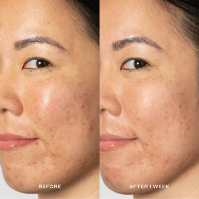 Тонік проти пігментних плям Olehenriksen GlowOH Dark Spot Toner 190 ml