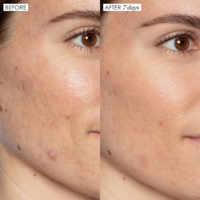 Сыворотка с молочной кислотой Sunday Riley Good Genes All-In-One Lactic Acid Treatment 15 ml (без коробочки, из набора)