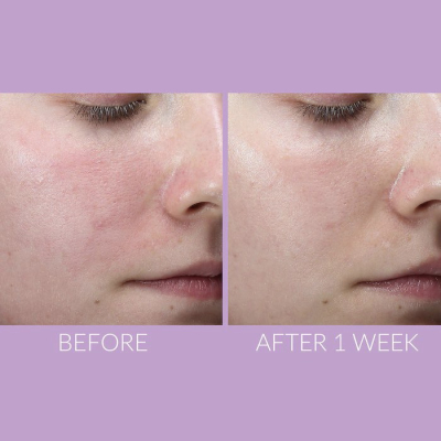 Легкая сыворотка Kate Somerville Delikate Recovery Serum 10 ml (без коробочки, из набора)