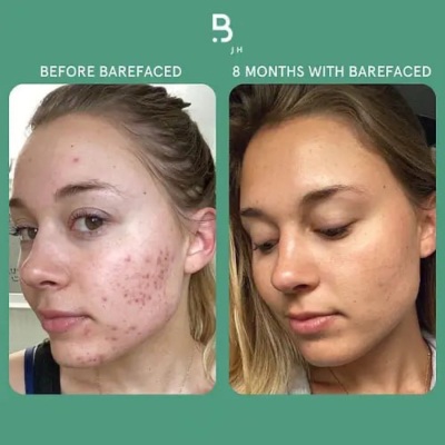 Освітлювальний засіб для вмивання Revision Skincare Brightening Facial Wash 100 ml