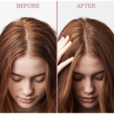 Відлущуючий скраб для шкіри голови проти лупи Umberto Giannini Scalp Scrub Exfoliating Anti-Dandruff Treatment 200 ml (без коробочки, з набору)