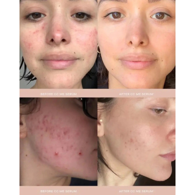 Суперпотужна сироватка з вітаміном С та ніацинамідом Summer Fridays CC Me Serum With Vitamin C + Niacinamide 30 ml