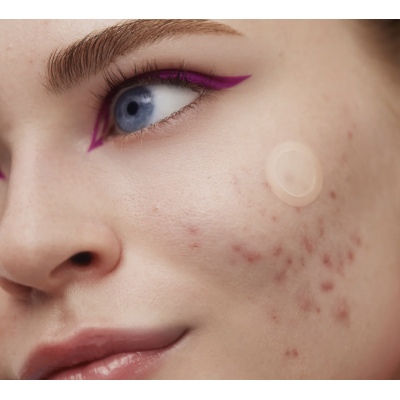 Точечные патчи от прыщей Peace Out Early Stage Acne Dots 8 шт