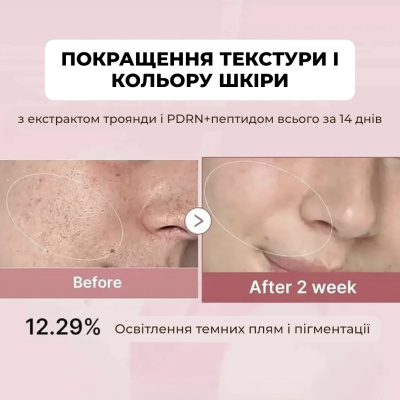 Відновлювальний молочний тонік з PDRN Medicube Pink PDRN Niacinamide Milky Toner 150 ml
