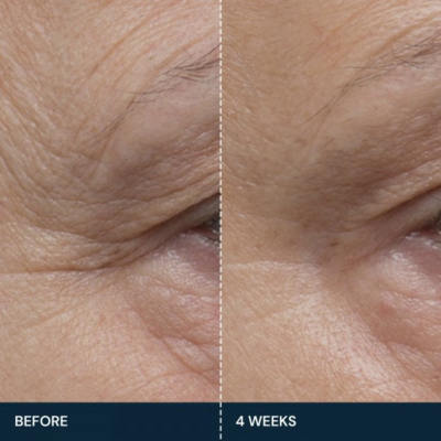 Укрепляющая сыворотка для лица Elemis Pro Collagen Future Restore Serum 15 ml Travel Size