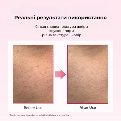 Сыворотка-бустер для укрепления и восстановления кожи Arencia PDRN Booster Shot Face and Eye Moisturizer 30 ml