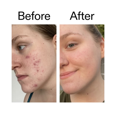 Осветляющая сыворотка от гиперпигменации The Inkey List 15% Vitamin C and EGF Serum 30 ml