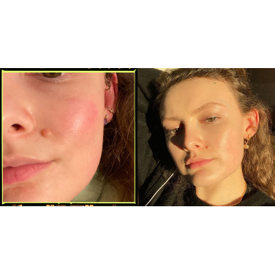 Успокаивающая сыворотка уменьшающая покраснение уже через 30 минут Ren Evercalm Redness Relief Serum 30 ml