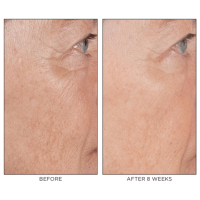 Зволожуюча сироватка для обличчя Perricone MD High Potency Hyaluronic Intensive Hydrating Serum 7.5 ml