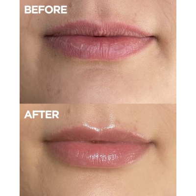 Бальзам для губ Lanolips 101 Ointment Multi-Balm Coconutter 10 g