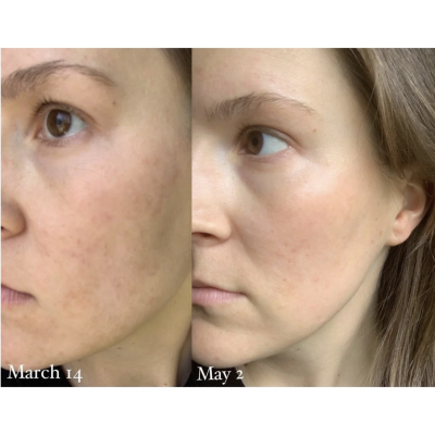 Освітлююча сироватка від пігментації Holifrog Sunnyside Vitamin C Brightening Day Serum 30 ml