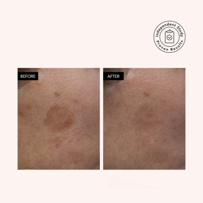 Освітлююча сироватка для обличчя Odacite Brightening Serum Vitamin C & E + Hyaluronic Acid 30 ml