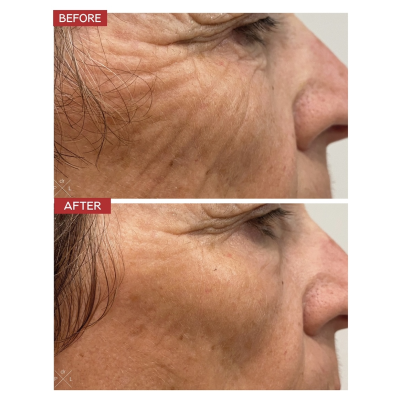 Охлаждающая маска для лица Dr.Levy Freezing Anti-Fatigue Mask 50 ml