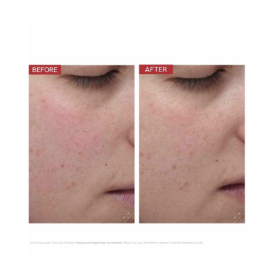 Охолоджуюча маска для обличчя Dr.Levy Freezing Anti-Fatigue Mask 50 ml