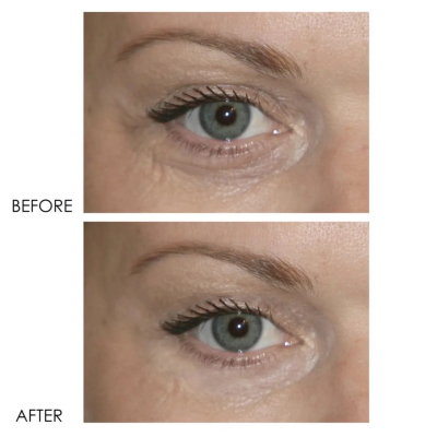 Професійний засіб проти темних кіл та обвислих повік Dermelect Revitalite Eyelid & Dark Circle Corrector 15 ml