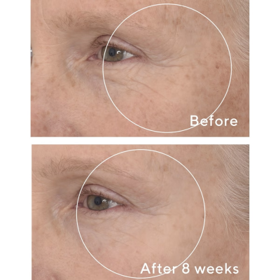 Антивікова ліфтинг-сироватка для шкіри обличчя Murad Retinal ReSculpt Overnight Treatment 30 ml