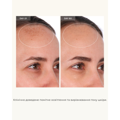 Розгладжуюча сироватка для обличчя U Beauty Resurfacing Compound 10 ml Mini