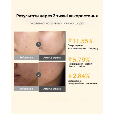 Освітлювальний тонік з койєвою кислотою Medicube Kojic Acid Turmeric Resurfacing Toner 250 ml