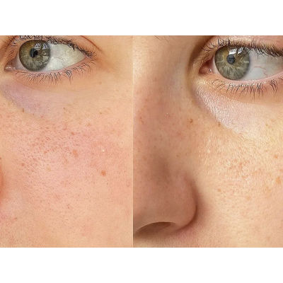 Отшелушивающий лосьон с салициловой кислотой Paula's Choice Calm - 1% BHA Lotion Exfoliant 100 ml (без коробочки, из набора)