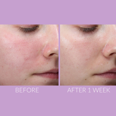 Сыворотка для чувствительной кожи Kate Somerville Delikate Recovery Serum 30 ml