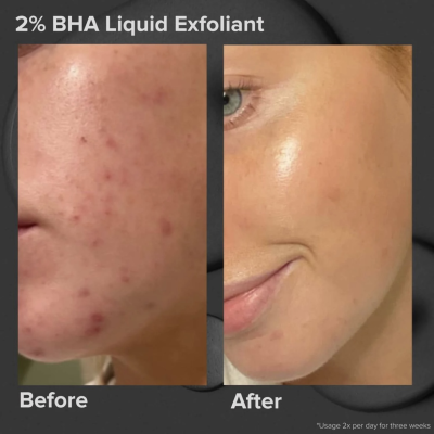 Відлущуючий засіб Paula's Choice Skin Perfecting 2% BHA Liquid Exfoliant 118 ml