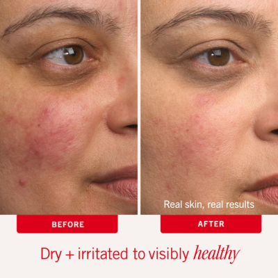 Интенсивно увлажняющий крем для сухой и чувствительной кожи First Aid Beauty Ultra Repair Cream Intense Hydration 170.1 g