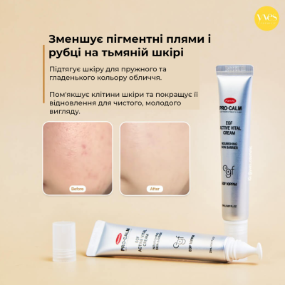 Відновлювальний крем для обличчя Hanmi Pro-Calm EGF Active Vital Cream 20 ml