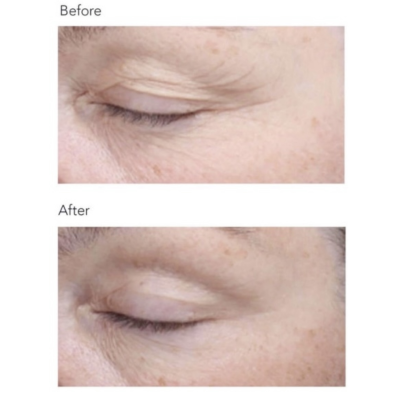 Омолаживающая сыворотка Bioeffect EGF Serum 5 ml Mini