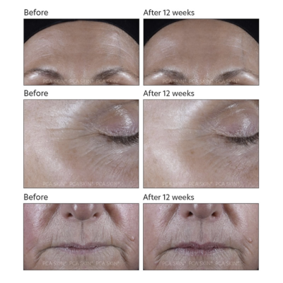 Пептидная сыворотка PCA Skin ExLinea Pro Peptide Serum 5 ml Mini