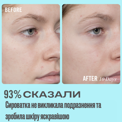 Сыворотка с витамином С для чувствительной кожи лица First Aid Beauty 10% Vitamin C Brightening Serum 50 ml