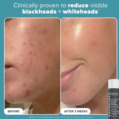 Набор для отшелушивания и увлажнения кожи Paula's Choice Exfoliation Icons Kit