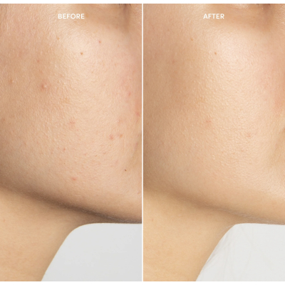 Революційний шовковистий крем миттєвого освітлення плям зі стабілізованим вітаміном С Lancer Instant Brightening Booster 7.5 ml