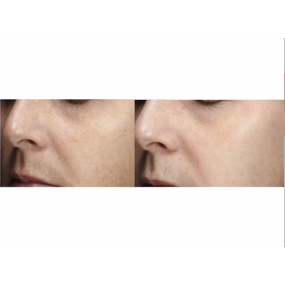 Освітлююча сироватка для обличчя PCA Skin Vitamin B3 Brightening Serum 7.1 ml Mini