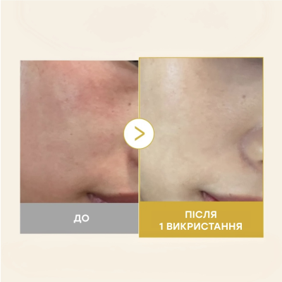 Гелева сироватка-спрей для освітлення шкіри Medicube Kojic Acid Turmeric Vita Jelly Mist Serum 100 ml