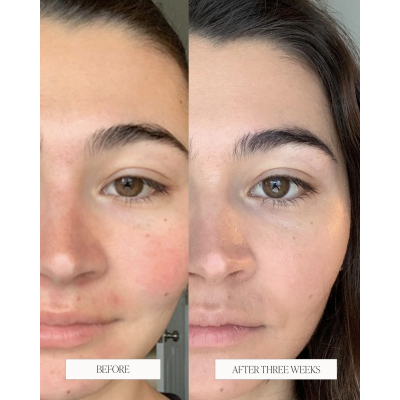 Зволожуюча есенція для обличчя Byroe English Breakfast Tea Treatment Essence 120 ml