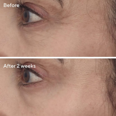 Розгладжуючий крем з ретинолом для шкіри навколо очей Murad Retinal ReSculpt Eye Treatment 15 ml