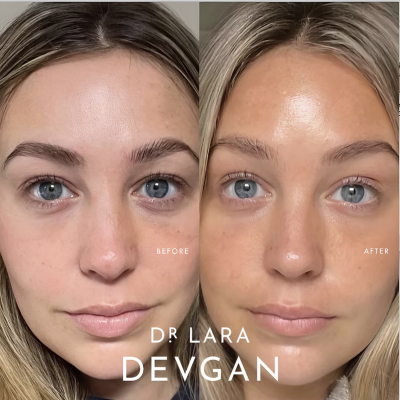 Пептидный крем для омоложения кожи глаз Dr. Lara Devgan Peptide Eye Cream 15 g