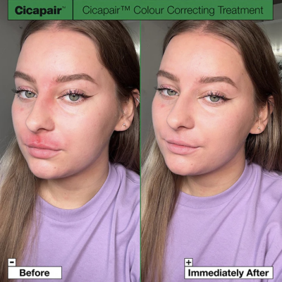 Корегуючий крем від почервонінь Dr.Jart+ Cicapair Tiger Grass Color Correcting Treatment 5 ml Mini