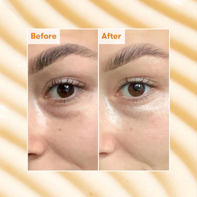 Освітлюючий крем для шкіри навколо очей Ren Brightening Dark Circle Eye Cream 15 ml