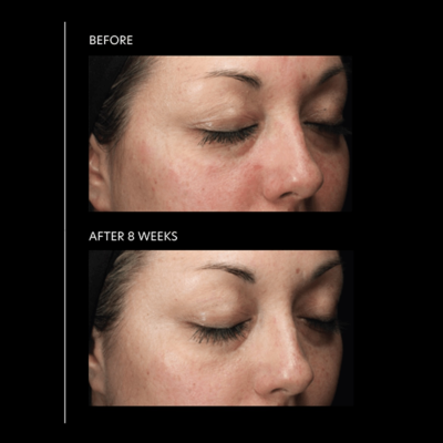 Матуючий крем-гель для обличчя PCA Skin HydraMatte Oil-Controlling Hydration 7 g Mini