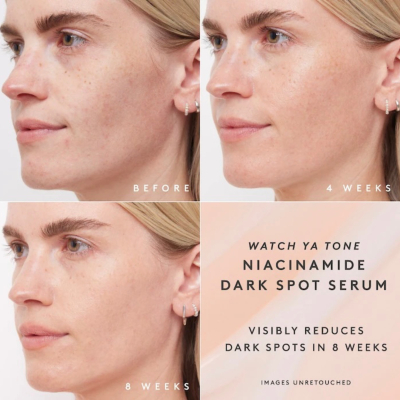 Сыворотка против пигментации Fenty Skin Watch Ya Tone 5% Niacinamide Dark Spot Serum 30 ml