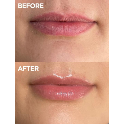 Бальзам для губ Lanolips 101 ointment multi-balm Strawberry 10 g