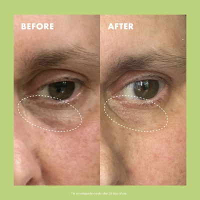 Осветляющий крем под глаза с ниацинамидом и кофеином Kopari Niacinamide & Caffeine Eye Bright Cream 15 ml