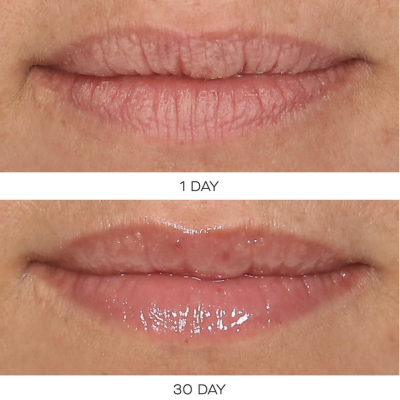 Бальзам для губ с эффектом увеличения U Beauty The Plasma Lip Compound (Universal) 15 ml