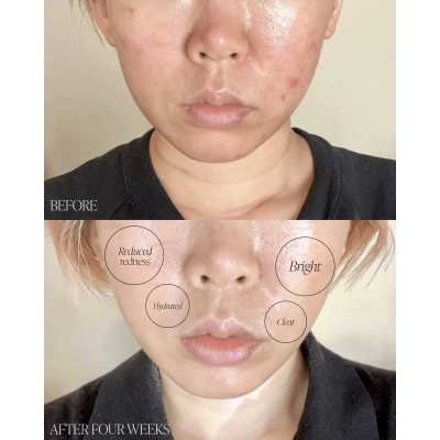 Увлажняющий крем для лица от пигментации Byroe Basil Dark Spot Correcting Cream 30 ml