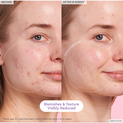 Сироватка із ретинолом Glow Recipe Blackberry Retinol Blemish Serum 30 ml