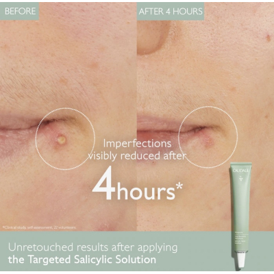 Крем точкового нанесення для швидкого усунення прищів Caudalie Vinopure Stop Boutons Salicylique 15 ml